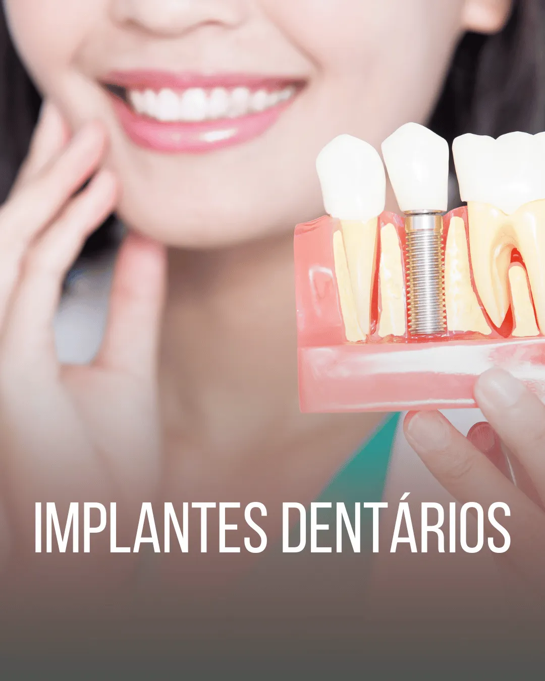 Reposição funcional e estética com precisão cirúrgica.