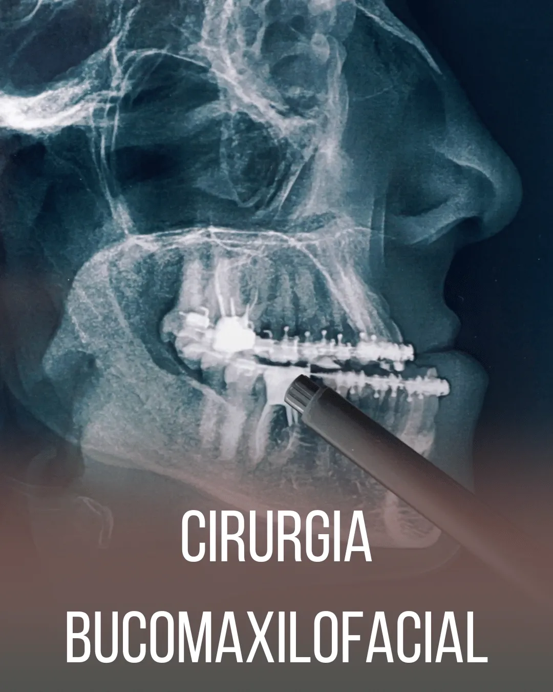 Tratamento de DTM, traumas de face, ortognática e mais.