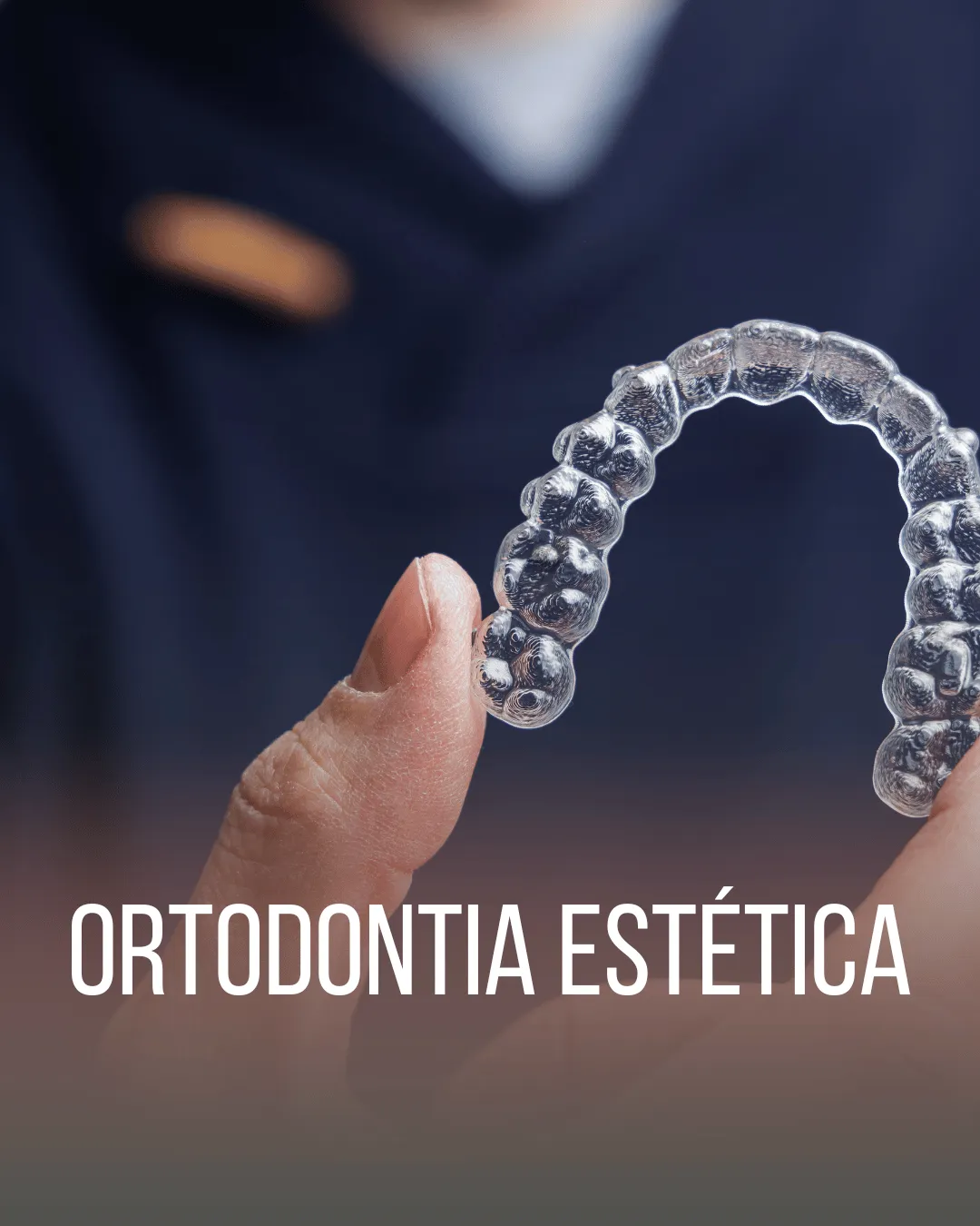 Alinhadores invisíveis e aparelhos estéticos.
